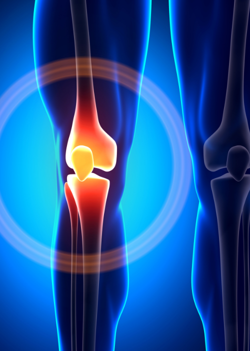 Dislipidemia e problemas de saúde óssea